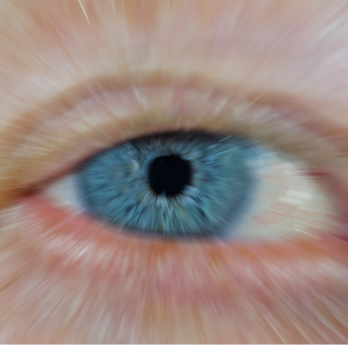Mögliche Ursachen schwarzer Punkte im Auge Verschwommenes Sehen durch schwarze Punkte oder Glaskörperabhebung